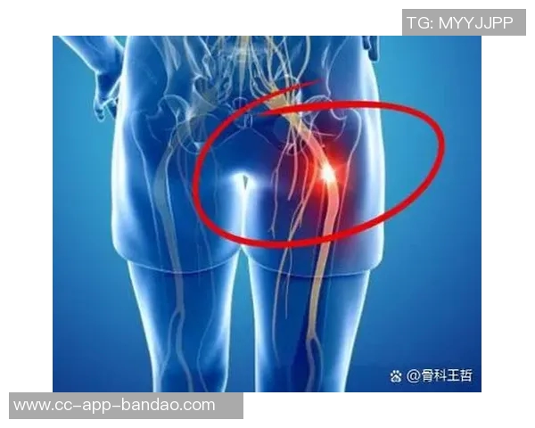 专家解读坐骨神经痛成因及治疗方法大多数患者可避免手术治疗